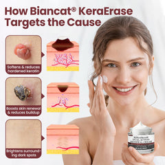 Biancat® KeraSoft Renewal Cream