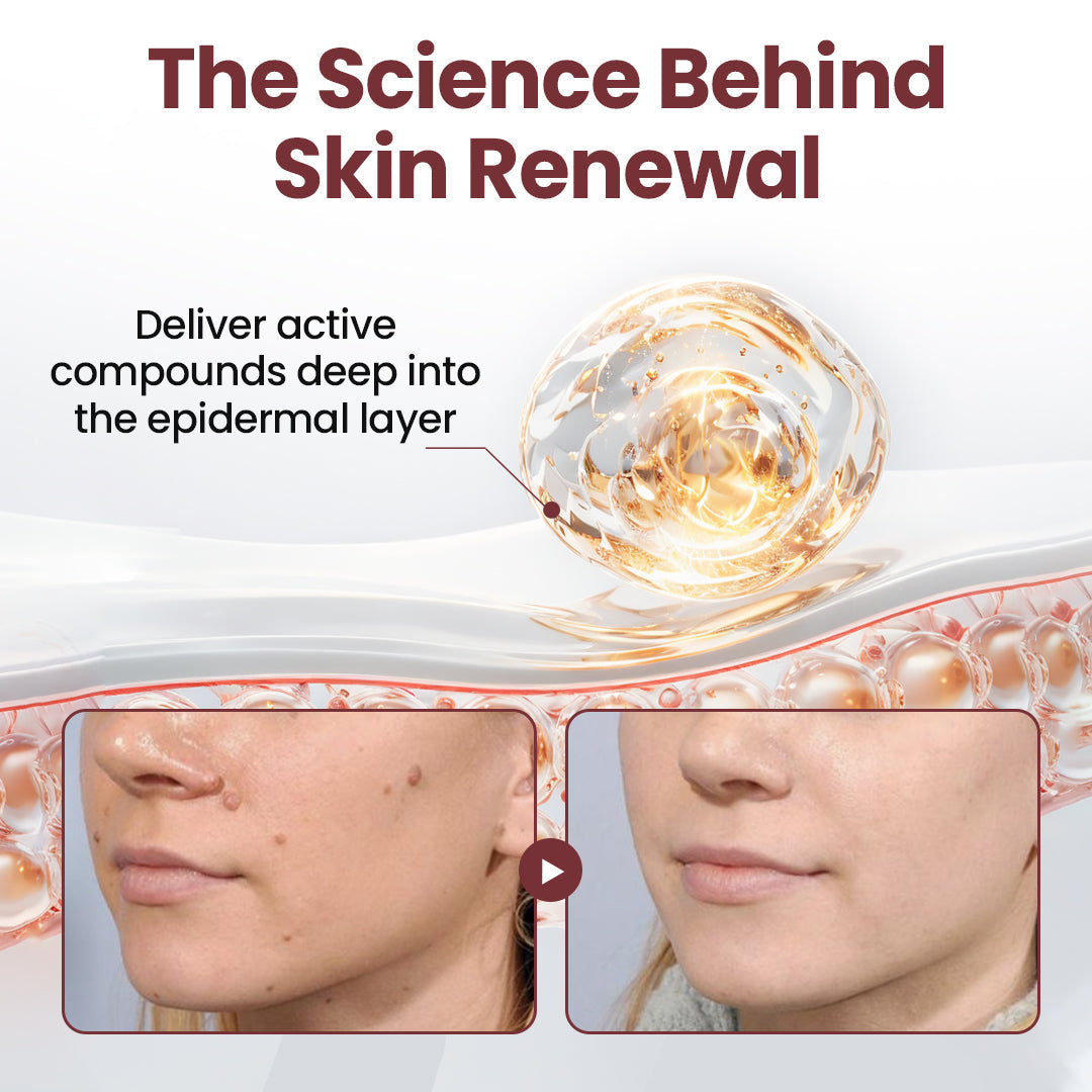 Biancat® KeraSoft Renewal Cream