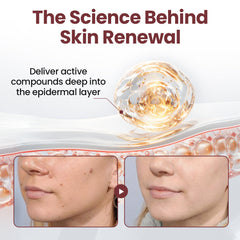 Biancat® KeraSoft Renewal Cream